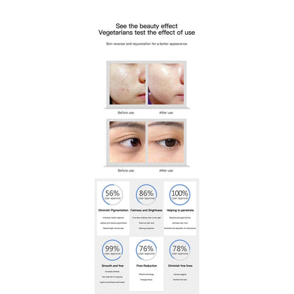 NewFace Portable Cuidado De La Cara Piel Facial Cleanser Blackhead Remover Massage Brush Exfoliating Beauty Skin Scrubber Device